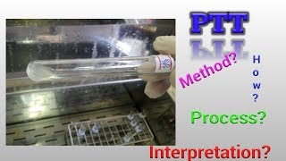 Prothrombin Time Test PT Hematology [upl. by Darryl]