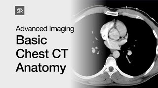 Advanced Imaging Basic Chest CT Anatomy [upl. by Htehpaj]