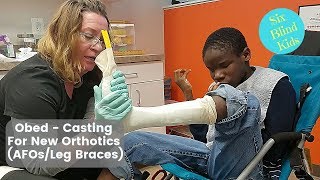 SixBlindKids  Obed  Casting For New Orthotics AFOsLeg Braces [upl. by Aznerol]