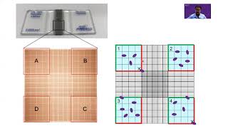 Counting cells on a hemocytometer [upl. by Aenea]