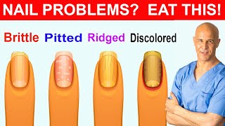 NAIL PROBLEMS  EAT THIS  Dr Mandell [upl. by Ninnette330]