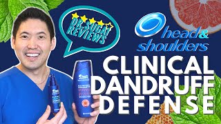 The Scalp Guru  What Causes Dandruff and How to Treat It [upl. by Sillad]