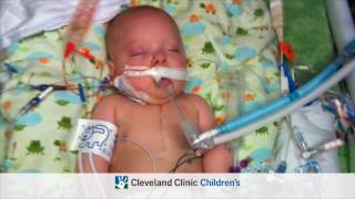 Congenital Heart Disease Tetralogy of Fallot Full Version [upl. by Enirolf613]