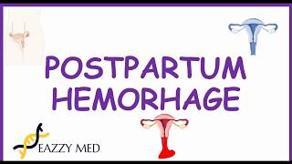 Postpartum Hemorrhage PPH causesrisk factorsprevention and treatment [upl. by Rosner]