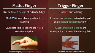 Mallet Finger Explained by Dr Alexander Anzarut [upl. by Aicilif]