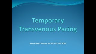 Temporary Tranvenous Pacing [upl. by Ulrica397]