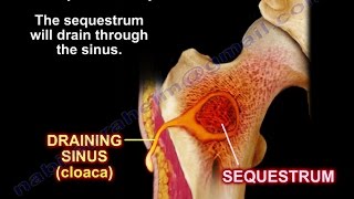 The Role and Anatomy of the Pancreas [upl. by Hendrika430]