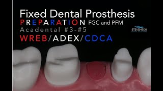 Fixed Dental Prosthesis Preparation  35 Acadental  WREBADEXCDCA [upl. by Tarazi]