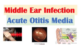 How to distinguish lymph node swelling from other lumps near ear  Dr Honey Ashok [upl. by Jasisa309]