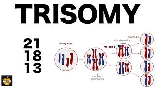 Trisomy 21 18 and 13 amp Nondisjunction Genetics [upl. by Beryl]