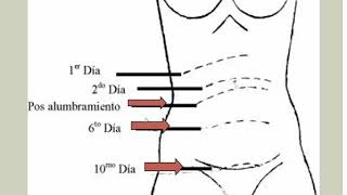 Puerperio Normal  Obstetricia  Clase 81 [upl. by Hebner]