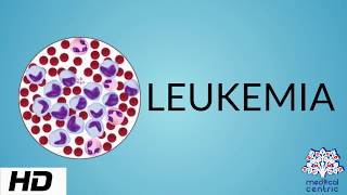 Leukemia  Causes and Symptoms  Part 33 [upl. by Losyram]