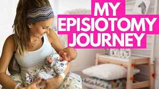 How I overcame PAIN after my episiotomy [upl. by Llenehs507]