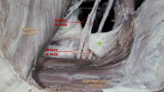 Suprascapular Nerve Block [upl. by Imelida902]