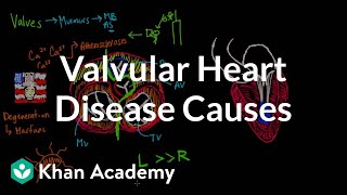 Valvular heart disease causes  Circulatory System and Disease  NCLEXRN  Khan Academy [upl. by Filomena]