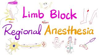 Limb Block  Peripheral Nerve Block  Regional anesthesia [upl. by Tichonn]