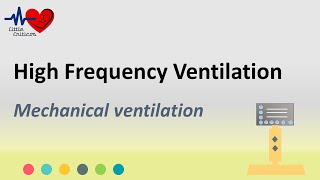 SLE5000  15 High Frequency Oscillation Ventilation [upl. by Lleoj]