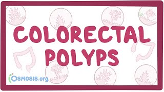 Colorectal Cancer Surgery principles and types [upl. by Goldfinch]