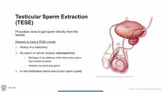 Testicular Sperm Extraction TESE Procedure Overview [upl. by Lesly]