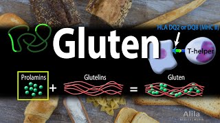 Gluten Sensitivity Story  How Going Gluten Free Changed My Life Gluten Intolerance Symptoms [upl. by Nolra675]