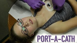 Subcutaneous ICD SICD implant Patient Prep and Draping [upl. by Torrell416]