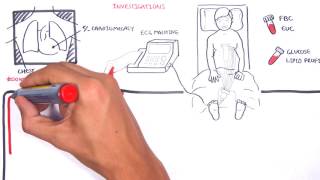 Acute Coronary Syndrome DETAILED Overview MI STEMI NSTEMI [upl. by Fagen380]