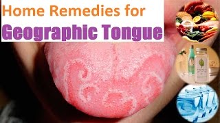 How to Clean Your Tongue  Benefits of Tongue Scraping [upl. by Arahs475]