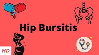 Hip Bursitis Causes Signs and Symptoms Diagnosis and Treatment [upl. by Jeanette]