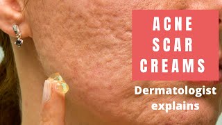 Acne Scar Creams  Dermatologist Reviews [upl. by Aterg573]