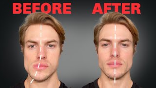 How to Fix Asymmetrical Jaw amp Face FOREVER [upl. by Bear886]