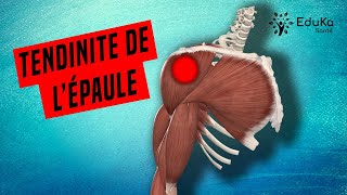 COMPRENDRE LA TENDINITE DE LÉPAULE Explications professionelles [upl. by Issy]