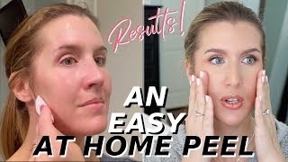 At Home Glycolic Acid Peel THAT WORKS  Over 40 Skincare [upl. by Enar786]