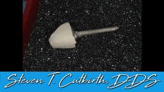 Core Post and Crown  with Steven T Cutbirth DDS [upl. by Garris]