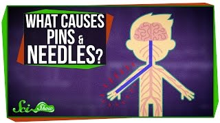 What Causes Pins and Needles [upl. by Janaye]