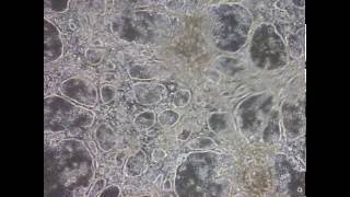 Heart Cells derived from iPSC Stem Cells beat in Culture Dish [upl. by Ellenrahc]