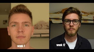 Patchy blonde beard Time Lapse  3 Months [upl. by Gibby]