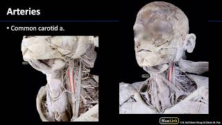 Anterior Neck  Arteries [upl. by Iveson]