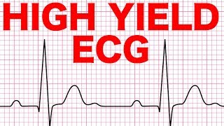 Electrocardiograms ECG Made Easy [upl. by Bushore]