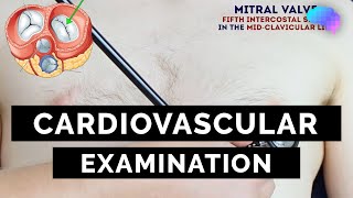 Cardiovascular Examination  OSCE Guide  UKMLA  CPSA  PLAB 2 [upl. by Wrightson209]