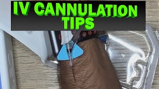 Inserting IV Cannulation  IV Tips for Nurses Paramedics etc [upl. by Canter236]