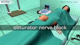 Obturator Nerve Block [upl. by Hairom]