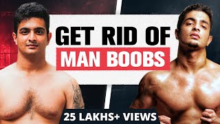 What is Gynecomastia and how common is it Gynecomastia Man Boobs  Dr Sunil Kumar KS MHW [upl. by Alyaj]