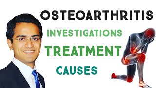 Osteoarthritis  causes symptoms diagnosis treatment amp pathology [upl. by Leunam]