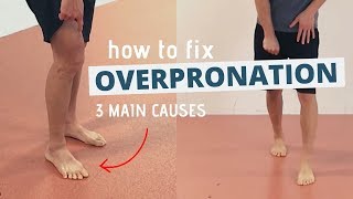 Pronated Feet and How to Fix 3 Different Causes of OVERPRONATION [upl. by Erdda]