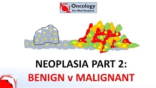 2 Neoplasia part 2 Differences between benign and malignant neoplasms [upl. by Ettener]