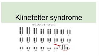 Klinefelter syndromeGenetics Characteristics Diagnosis [upl. by Turpin200]