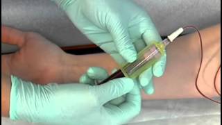 Sample Procedure  Venipuncture Butterfly Method [upl. by Elfreda]