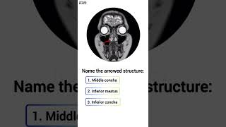 👃Anatomy Quiz👃 [upl. by Ernest]