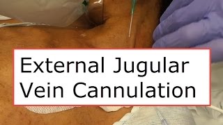 External Jugular Vein Cannulation [upl. by Allanson]