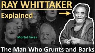 RAY WHITTAKER Explained The Man Who Grunts and Barks [upl. by Witcher]